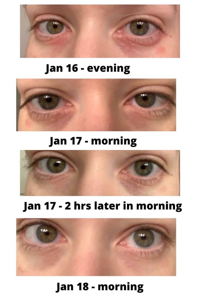 eye rash Jan 16 to 18 2020